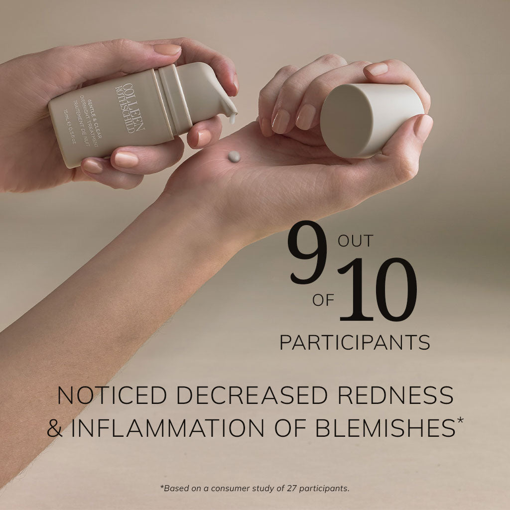 Gentle &amp; Clear Overnight Treatment | 9 out of 10 noticed decreased redness &amp; inflammation of blemishes.  